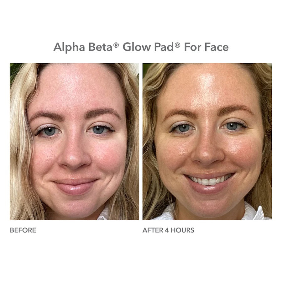 Dr. Dennis Gross Alpha Beta Glow Pad Intense Glow