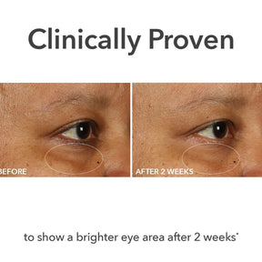 Dr. Dennis Gross DermInfusions Fill + Repair Eye Cream