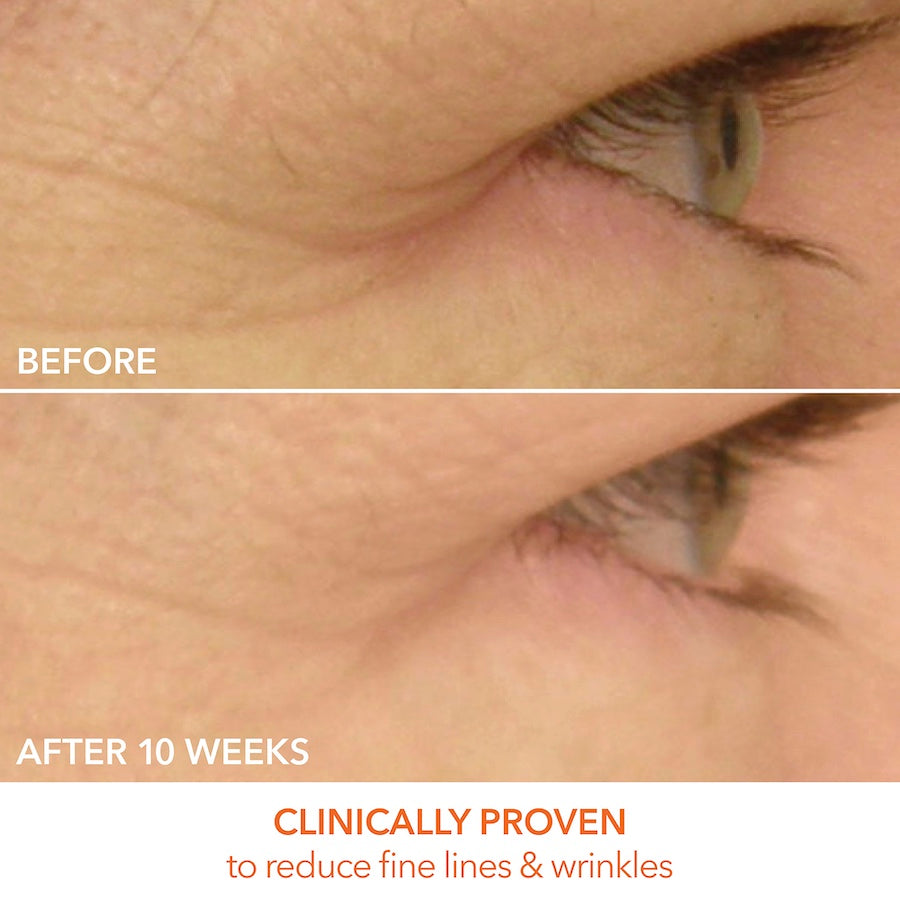 Dr. Dennis Gross SpectraLite™ Eye Care Max Pro