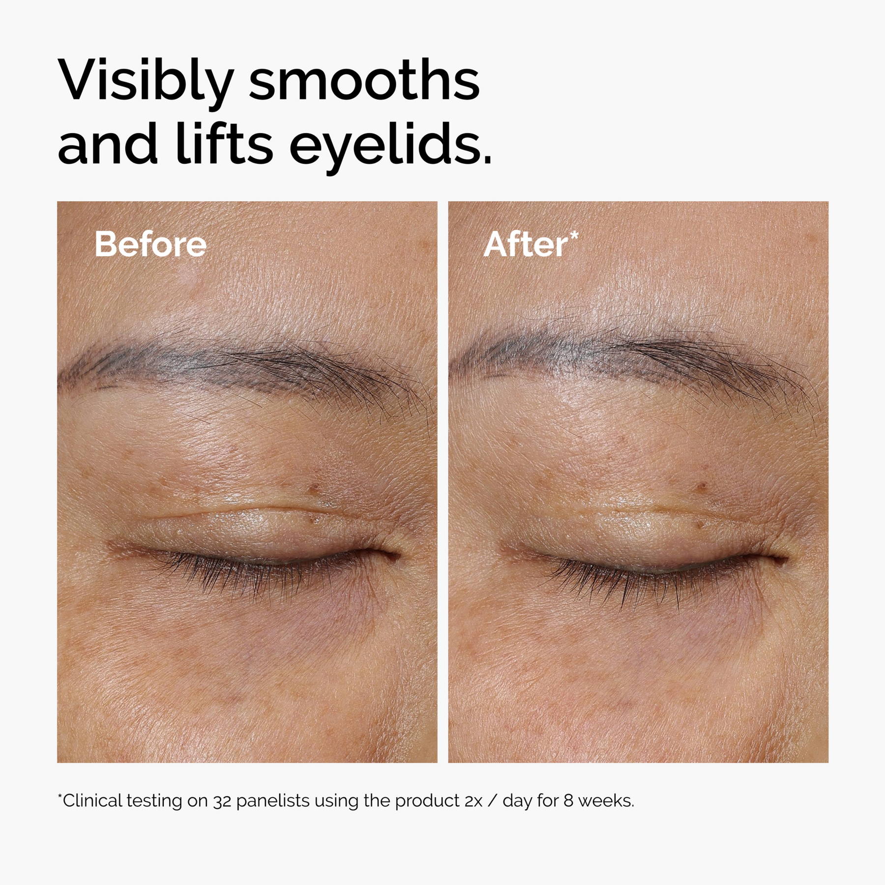 The Ordinary Lacto-PDRN 4% + B9 Lifting & Tightening Eye Cream