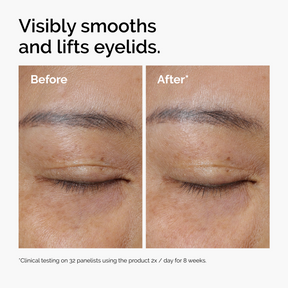 The Ordinary Lacto-PDRN 4% + B9 Lifting & Tightening Eye Cream